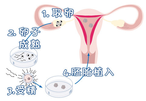 胚胎培养